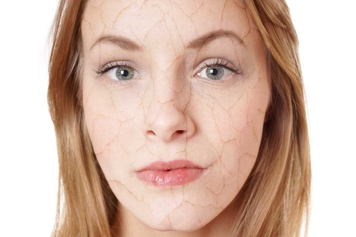 The Top Healthy Skin Habits for Eczema and Psoriasis